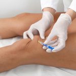 How Long Does a Knee Injection for Arthritis Last? | Arthritis Relief Centers
