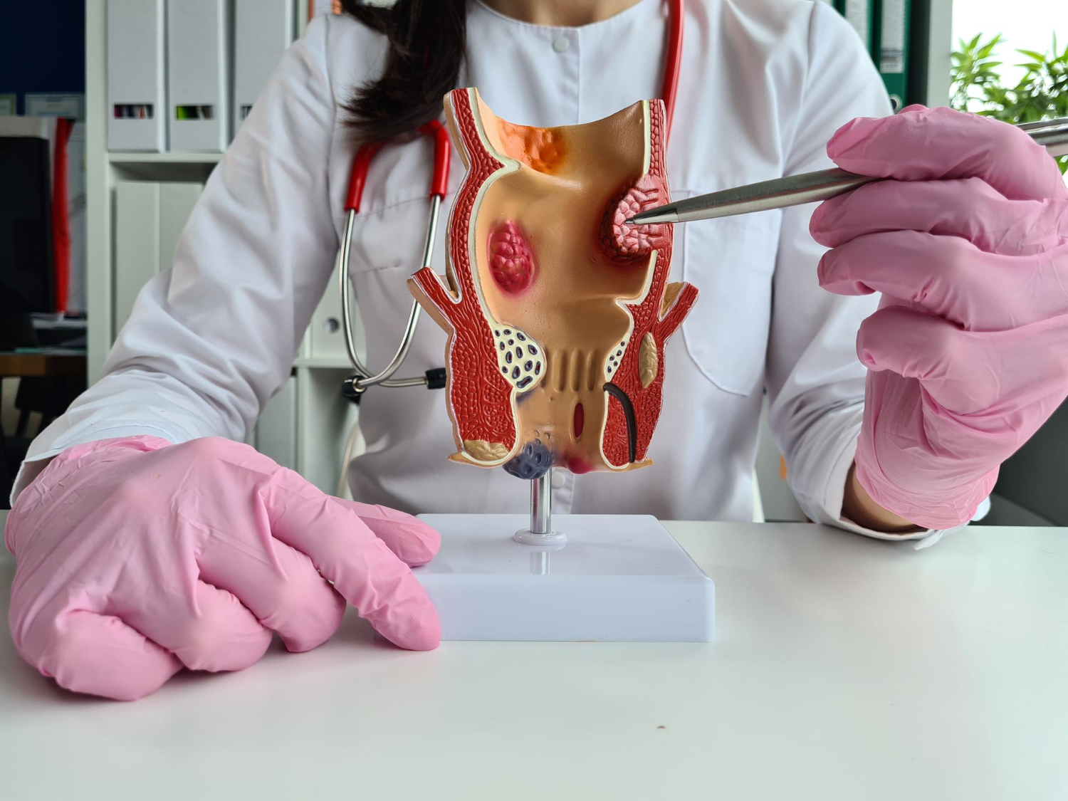 treatment-diseases-rectum-hemorrhoids-constipation